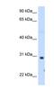 ST3 Beta-Galactoside Alpha-2,3-Sialyltransferase 3 antibody, NBP1-60067, Novus Biologicals, Western Blot image 