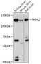 SRSF Protein Kinase 2 antibody, 16-977, ProSci, Western Blot image 