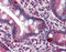 ST13 Hsp70 Interacting Protein antibody, 49-007, ProSci, Immunohistochemistry frozen image 