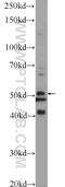 Transmembrane Phosphoinositide 3-Phosphatase And Tensin Homolog 2 antibody, 25120-1-AP, Proteintech Group, Western Blot image 