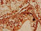 Protein Arginine Methyltransferase 7 antibody, CSB-PA885738LA01HU, Cusabio, Immunohistochemistry paraffin image 