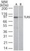 Toll Like Receptor 5 antibody, MA5-16237, Invitrogen Antibodies, Western Blot image 