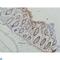 Galectin 3 antibody, LS-C812353, Lifespan Biosciences, Immunohistochemistry paraffin image 