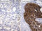 Tripartite Motif Containing 29 antibody, M04472-1, Boster Biological Technology, Immunohistochemistry paraffin image 