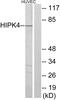 Homeodomain Interacting Protein Kinase 4 antibody, PA5-38734, Invitrogen Antibodies, Western Blot image 