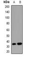 Suppressor Of Cytokine Signaling 2 antibody, orb382604, Biorbyt, Western Blot image 