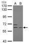 Elongator Acetyltransferase Complex Subunit 3 antibody, PA5-22196, Invitrogen Antibodies, Western Blot image 