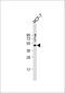 Suppressor Of Variegation 3-9 Homolog 1 antibody, 57-423, ProSci, Western Blot image 