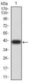 Choriogonadotropin subunit beta antibody, NBP2-61789, Novus Biologicals, Western Blot image 