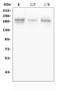 GLI Family Zinc Finger 2 antibody, A00701-5, Boster Biological Technology, Western Blot image 