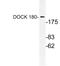 Dedicator Of Cytokinesis 1 antibody, LS-C177821, Lifespan Biosciences, Western Blot image 