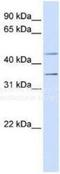 Purinergic Receptor P2Y12 antibody, NBP1-69246, Novus Biologicals, Western Blot image 