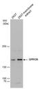 Adhesion G Protein-Coupled Receptor G6 antibody, PA5-78542, Invitrogen Antibodies, Western Blot image 