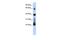 RNA Pseudouridine Synthase D3 antibody, GTX47194, GeneTex, Western Blot image 
