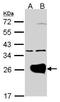 RAB1A, Member RAS Oncogene Family antibody, PA5-27421, Invitrogen Antibodies, Western Blot image 