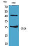 CD28 antibody, STJ96609, St John