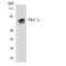 Protein Kinase C Alpha antibody, LS-C200492, Lifespan Biosciences, Western Blot image 