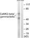 Calcium/Calmodulin Dependent Protein Kinase II Beta antibody, PA5-39732, Invitrogen Antibodies, Western Blot image 