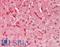 Fatty Acid Binding Protein 1 antibody, LS-B13806, Lifespan Biosciences, Immunohistochemistry paraffin image 