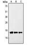 Translocator protein antibody, MBS820683, MyBioSource, Western Blot image 