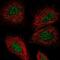Tsukushi, Small Leucine Rich Proteoglycan antibody, NBP1-87959, Novus Biologicals, Immunofluorescence image 