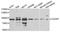 CD2 Associated Protein antibody, STJ110098, St John