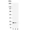 Cystatin C antibody, R30438, NSJ Bioreagents, Western Blot image 