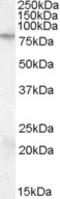 Exocyst complex component 7 antibody, 45-557, ProSci, Western Blot image 