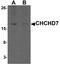 Coiled-Coil-Helix-Coiled-Coil-Helix Domain Containing 7 antibody, A11624, Boster Biological Technology, Western Blot image 