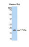 Hexosaminidase Subunit Beta antibody, LS-C294500, Lifespan Biosciences, Western Blot image 