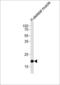 Cytochrome C Oxidase Subunit 6A2 antibody, LS-C166966, Lifespan Biosciences, Western Blot image 