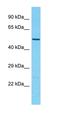 TBC1 Domain Family Member 3G antibody, orb327114, Biorbyt, Western Blot image 