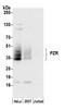 Myelin Protein Zero Like 1 antibody, A304-411A, Bethyl Labs, Western Blot image 
