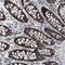 Mitochondrial RRNA Methyltransferase 1 antibody, PA5-54466, Invitrogen Antibodies, Immunohistochemistry paraffin image 