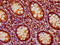 Pseudopodium Enriched Atypical Kinase 1 antibody, LS-C681023, Lifespan Biosciences, Immunohistochemistry paraffin image 