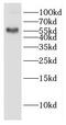 Galactose-3-O-Sulfotransferase 4 antibody, FNab03304, FineTest, Western Blot image 