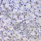 Lysine Acetyltransferase 5 antibody, A1678, ABclonal Technology, Immunohistochemistry paraffin image 