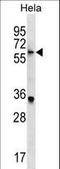 Kelch Like Family Member 22 antibody, LS-C160007, Lifespan Biosciences, Western Blot image 