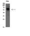 Tyrosyl-TRNA Synthetase antibody, A08583, Boster Biological Technology, Western Blot image 