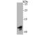 TYRO Protein Tyrosine Kinase Binding Protein antibody, A01996, Boster Biological Technology, Western Blot image 