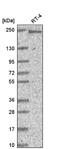 Polybromo 1 antibody, NBP2-55731, Novus Biologicals, Western Blot image 