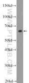 Peptidyl-prolyl cis-trans isomerase FKBP1B antibody, 18073-1-AP, Proteintech Group, Western Blot image 