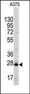 Chloride Intracellular Channel 1 antibody, AP14246PU-N, Origene, Western Blot image 