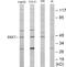 SS18 Subunit Of BAF Chromatin Remodeling Complex antibody, EKC1822, Boster Biological Technology, Western Blot image 