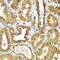 RAB1B, Member RAS Oncogene Family antibody, 22-997, ProSci, Immunohistochemistry paraffin image 