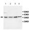 CDw210b antibody, ab106282, Abcam, Western Blot image 