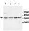 Interleukin 10 Receptor Subunit Beta antibody, ab106282, Abcam, Western Blot image 