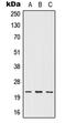 Interferon Omega 1 antibody, LS-C352342, Lifespan Biosciences, Western Blot image 