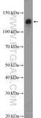 Cadherin 2 antibody, 22018-1-AP, Proteintech Group, Western Blot image 