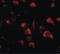 Sprouty Related EVH1 Domain Containing 3 antibody, LS-C82865, Lifespan Biosciences, Immunofluorescence image 